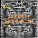 서울유플란트치과의원 이미지