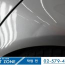 덴트존 이미지