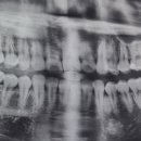 충주하나치과의원 이미지