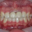 엠웍스 치과기공소 이미지