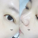 바른선 테라피 이미지