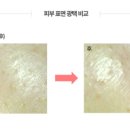 피부빛나다 이미지