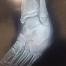 수정마취통증의학과의원 | 부산 수정동 수정88마취통증의학과의원 다녀오다