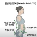 리해빗 | 뱃살, 운동만 해도 안 빠진다면? 체형 문제일 수 있습니다
