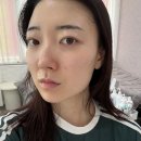 w-31 | w. 본식 한달 전, 부천 상동 피부관리[써니뷰티 부천상동점] 솔직 후기 | 부천신부관리 추천