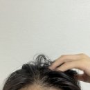 빈 헤어라인