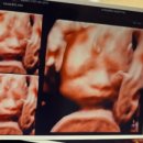 미래로21 | [엄빠의 하루] 미래로병원 2차 정밀초음파, 입체초음파 후기