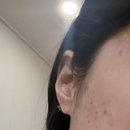 능곡예인의원 이미지