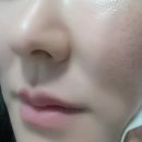 머리깍쨍이 | 라벨영 쇼킹식염수토너로 머리부터 발끝까지 촉촉해졌어요.