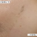 전문교육 ? DE;MAKE 니팅 | 평택피부관리 살롱드봉자 스킨플래닝 후기