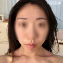 코스케어 | 구로에스테틱 숨스킨 피부관리 웨딩신부관리