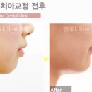 연세엘라인치과의원 네이버블로그