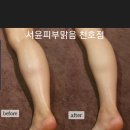 피부맑음 이미지