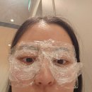 구리 하이엔드 피부과 내돈내산 비립종 제거 후기
