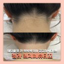 최지혜뷰티끄 | 청라왁싱 최지혜뷰티끄 뒷목 왁싱 후기 웨딩 왁싱 몇일전에 받는 게 좋을까?
