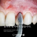 서울열린치과 이미지