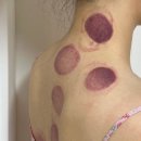 송가네냉면주는알밥집 | 9월의 일상(옥수동묵은지김치찜, 식빵 딸기잼 토스트, 떡볶이)