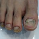 아이캔네일 이미지