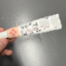 보고약국 | 색소침착연고 약국 제품 써보고 내린 결론과 효과 후기