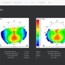 부산아이센터안경 이미지