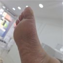 골든메디 | 대전 탄방동 발각질 매끈한 뒤꿈치 찾아주는 골든풋 대전점 페디쿱스