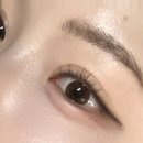 발품 10곳 판 나의 찐 쌍수후기