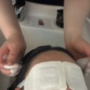 평택비전병원 | [평택] 두피관리 맛집 힐링 수기 케어‘CSLMGF 두피탈모센터 평택비전점’