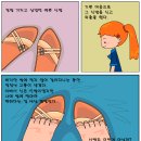 신발찜 이미지