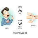 리튬 치료적 약물농도 감시(Lithium therapeutic drug monitoring) 이미지