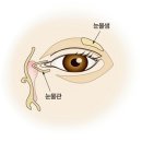 눈물흘림증(Epiphora) 눈 질환이란? 이미지