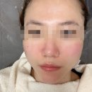 부산 하단 피부관리 유니뷰티 스킨플래닝 후기