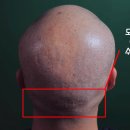 조선스칼프 이미지