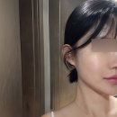 마디탄탄병원 | 써마지 가격 1개월차 후기 만족도 up