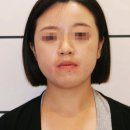 김종구희망드림치과의원 | 안면비대칭 교정 가격 5곳 비교 후 알게 된 점