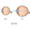 102 | 대전 고난시 안경, 눈 도수가 잘 교정되는 씨맥스렌즈로 맞춰보세요_안경진정성 대전전민점
