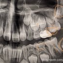 슈어치과교정과치과병원 이미지