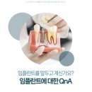 율하사랑심는치과의원 | 장유 율하 치과 임플란트 치료, 젊은 사람도 치료할 수 있나요?