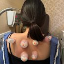 Dr.JK 동물병원 | [임신 22주] 임산부 부항 침치료 | 강아지 다래끼 마이봄샘 치료ing | 태동짤 | 임신주수별 배크기