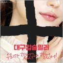 글래드성형외과의원 | 입술필러 대구 글래드성형외과 후기 선택 이유