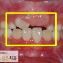 연세미소담은치과 이미지