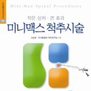 미니맥스 이미지