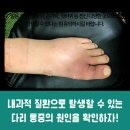 류마앤장내과의원 네이버블로그