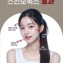진스킨피부과 네이버블로그
