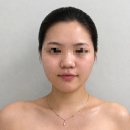 디엠메디컬 | 전주 얼굴경락 여드름 피부까지 개선되는 관리법