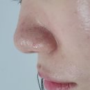 동래 지하철역(4호선) | 부산피부맛집 동래 마리뷰티 플라즈마 관리로 문제성피부 집중케어 솔직 후기