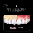 이세상치과기공소 이미지