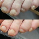 네일살롱바이선하 | 울산 내성발톱·무좀 관리 잘하는 곳｜네일바이선 후기