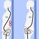 골반틀어짐 교정 및 원인, 확인 (골반 전방경사 후방경사) 이미지