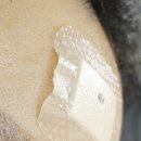 마라의샘 | +상처주의+빵꾸주의+ 이마에 빵꾸나서 꼬맸는데 다시 빵꾸가 재생된 후기