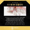 순천탑치과의원 네이버블로그
